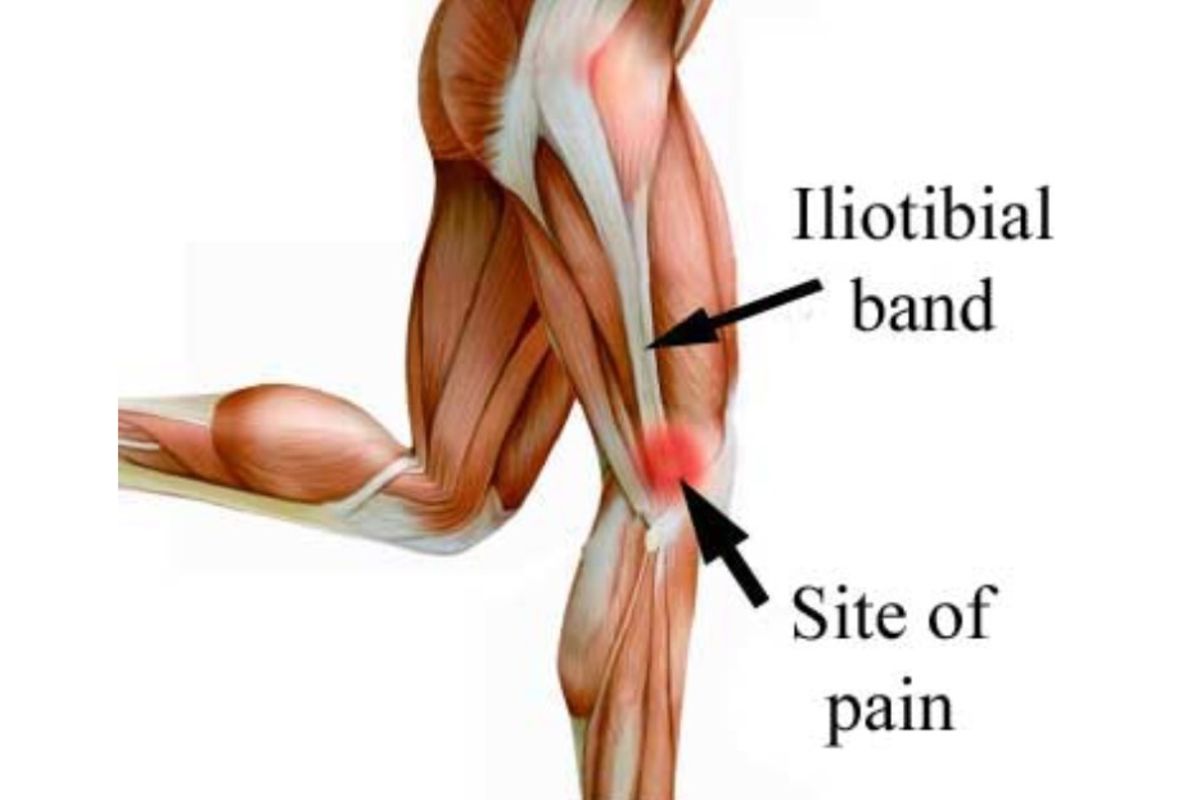 Iliotibial tract мышца