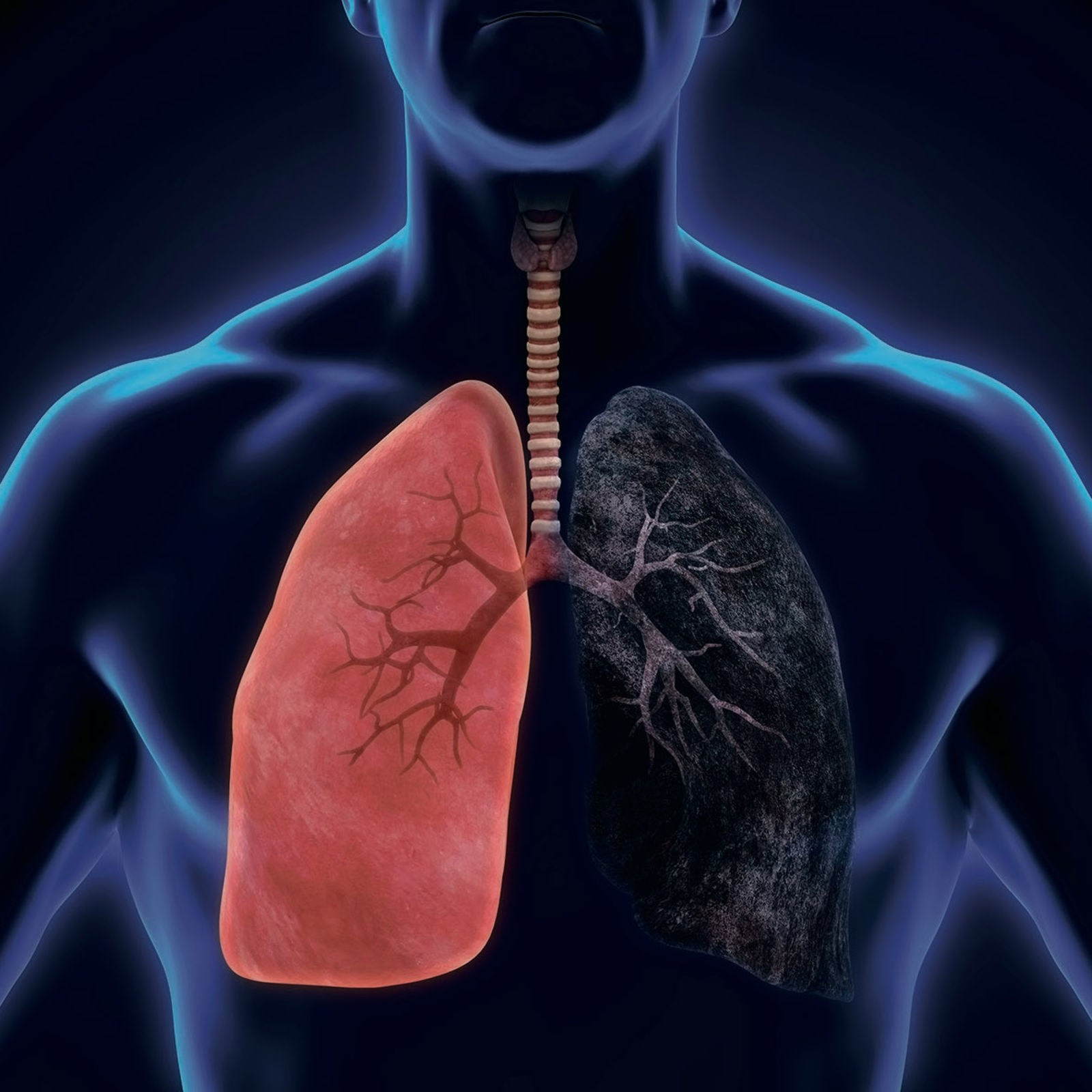 New technique for early lung cancer detection