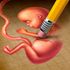 Abortion pic (1)