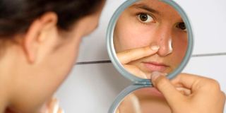 Acne is a skin caused by clogged pores and bacteria on the skin.