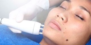 Available treatment options include extractions, steaming, chemical peels, and light therapy.