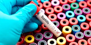 syphilis, stis, sexually transmitted infections