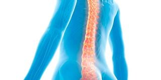 Degenerative disc disease is a condition that occurs when the discs in the spine begin to break down.