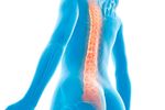 Degenerative disc disease is a condition that occurs when the discs in the spine begin to break down.