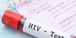 HIV test