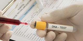 dna testing