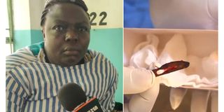 Felistah Nafula and the 11-year-old surgical blade that Maragua Level Four hospital doctors removed