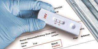 HIV test 