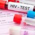 HIV test.