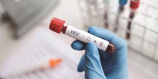 HIV Testing