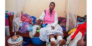 Mradi gas explosion survivor Maria Nyangige