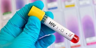 A long-term HIV prevention
