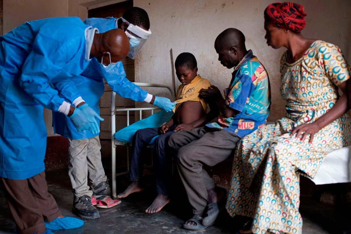 Kenya on high alert as Mpox virus is reported in DRC