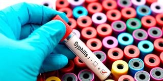 Syphilis testing